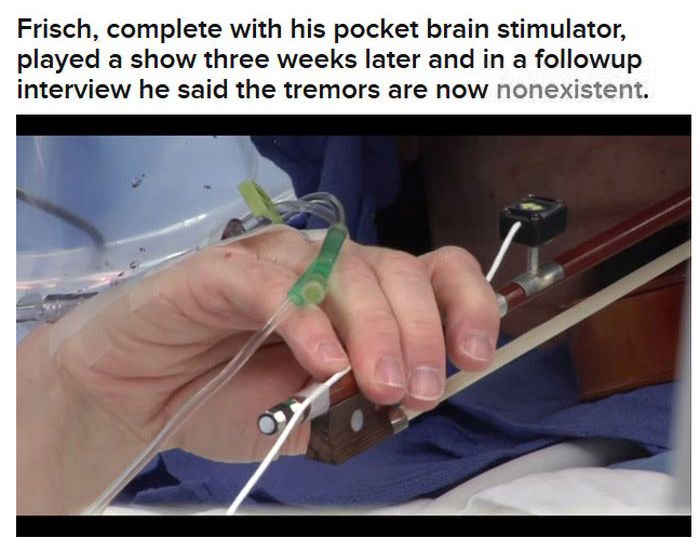 Man Plays Violin During His Own Brain Surgery (10 pics)