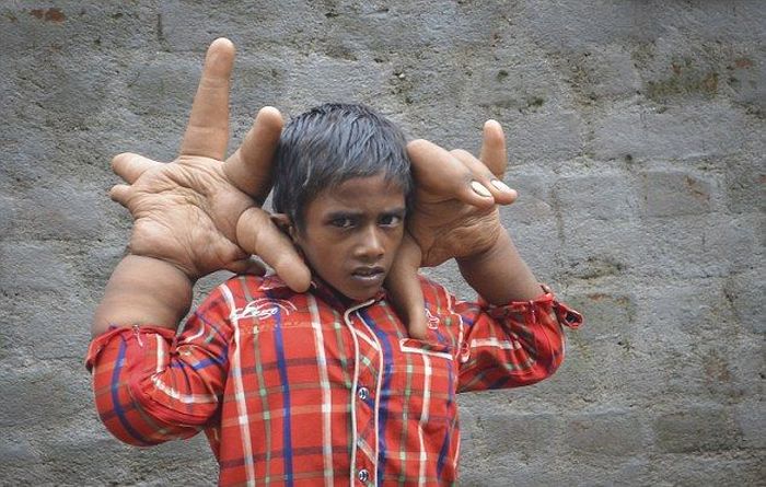 Little Boy With Big Hands (17 pics)