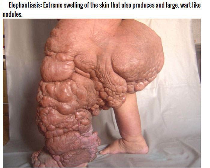 The Strangest Conditions And Defects People Are Born With (8 pics)