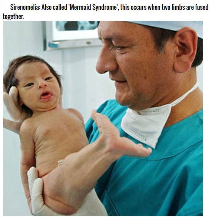 The Strangest Conditions And Defects People Are Born With (8 pics)
