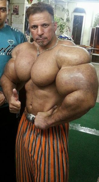 This Guy Uses Way Too Much Synthol (20 pics)