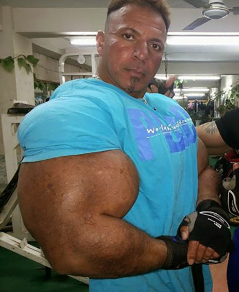 This Guy Uses Way Too Much Synthol (20 pics)