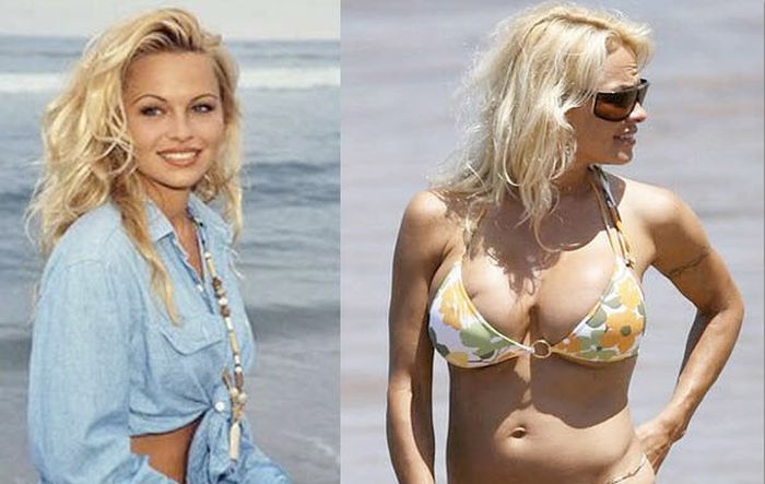 Celebrities Before And After Plastic Surgeries (22 pics)