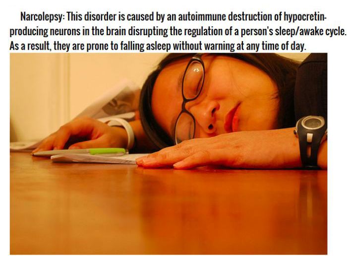 10 Terrifying Sleep Disorders (10 pics)