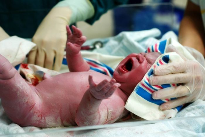 The Miracle Of Birth (40 pics)