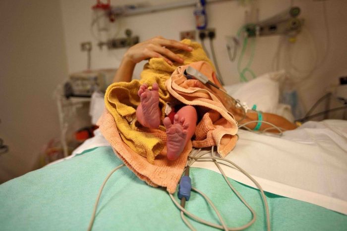 The Miracle Of Birth (40 pics)