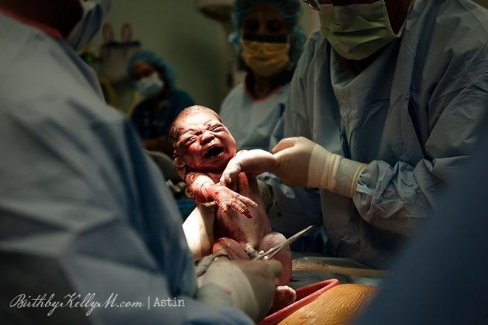 The Miracle Of Birth (40 pics)