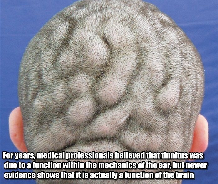 Facts You Didn't Know About Your Brain (25 pics)
