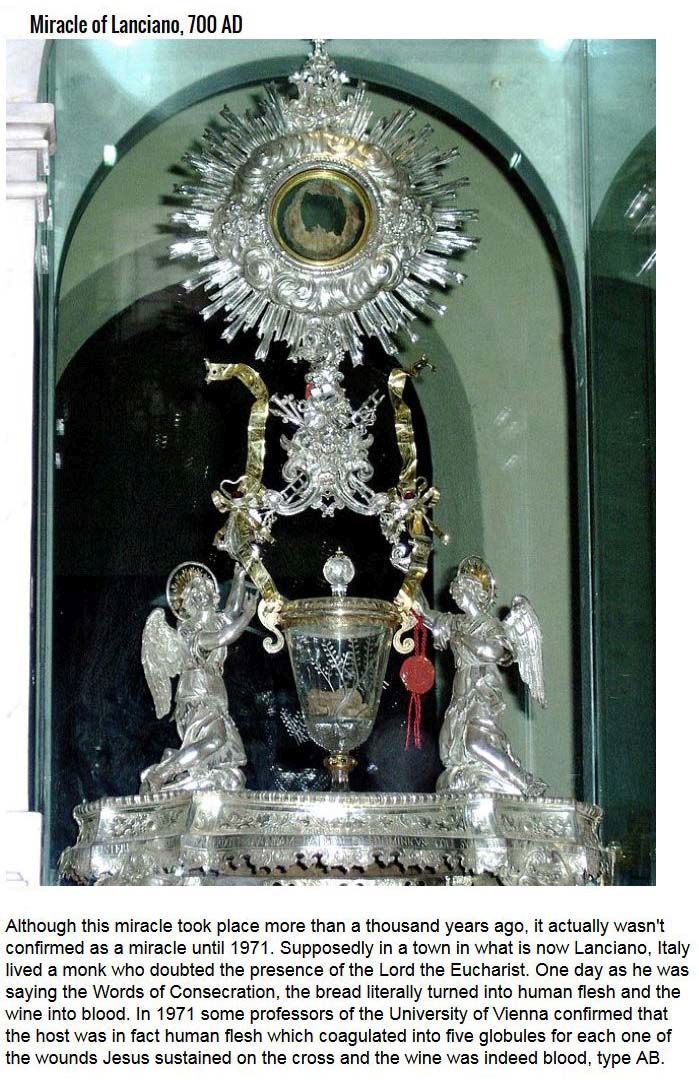 Modern Miracles That The Catholic Church Recognizes (7 pics)