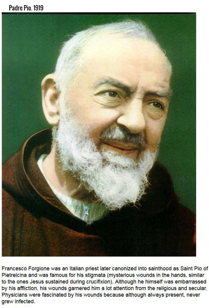 Modern Miracles That The Catholic Church Recognizes (7 pics)