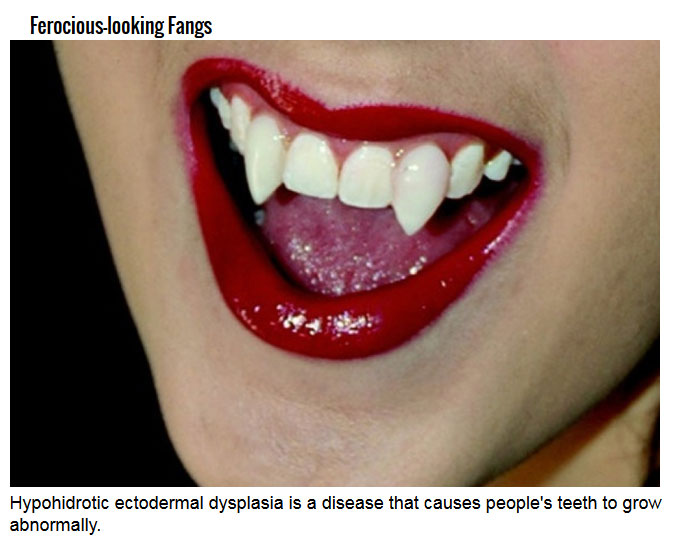 Humans Traits That Mimic Vampires (7 pics)