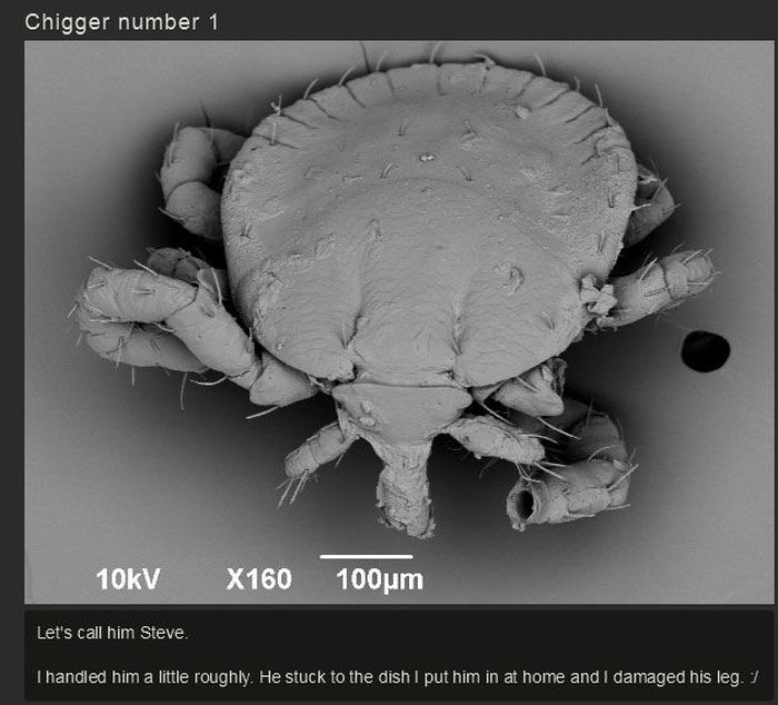You Won't Believe What This Person Found On Their Foot (17 pics)