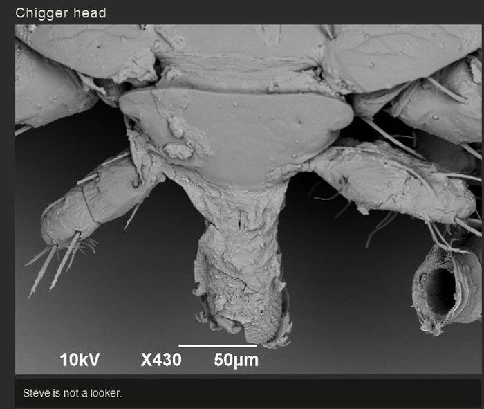 You Won't Believe What This Person Found On Their Foot (17 pics)