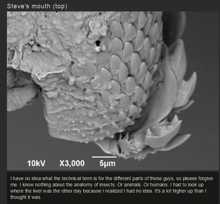 You Won't Believe What This Person Found On Their Foot (17 pics)