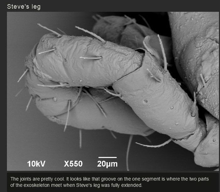 You Won't Believe What This Person Found On Their Foot (17 pics)