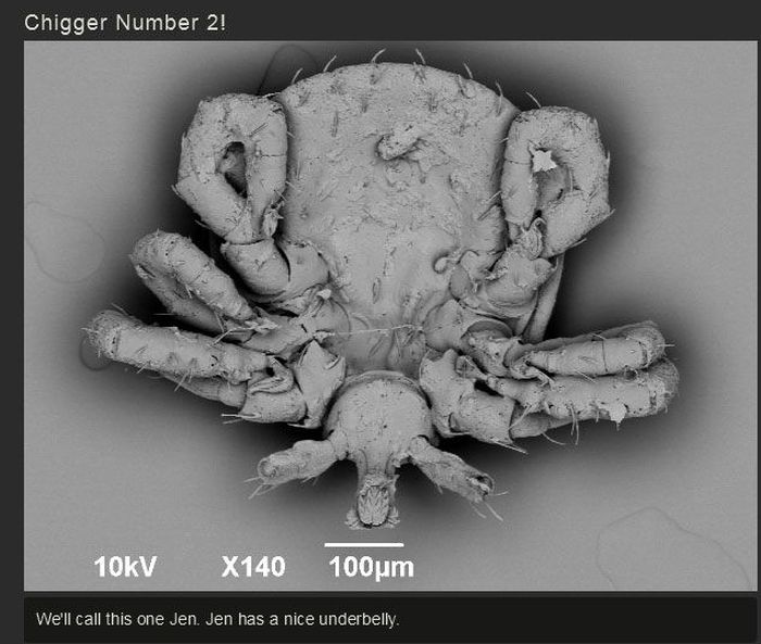 You Won't Believe What This Person Found On Their Foot (17 pics)