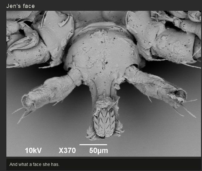 You Won't Believe What This Person Found On Their Foot (17 pics)