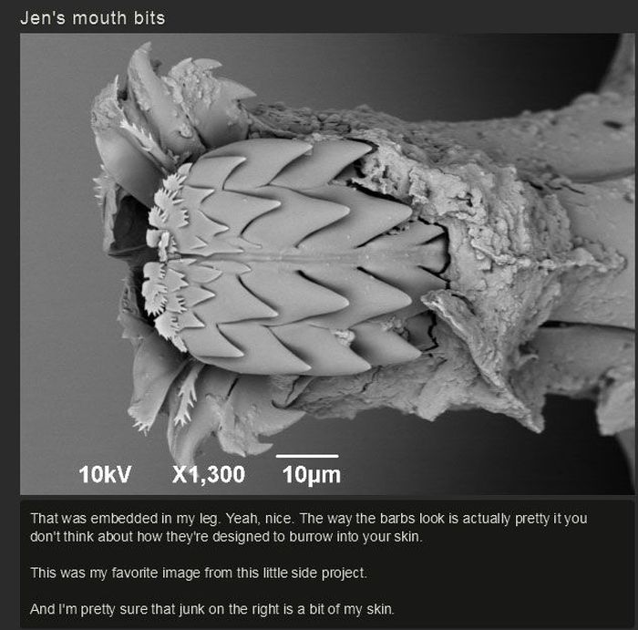 You Won't Believe What This Person Found On Their Foot (17 pics)