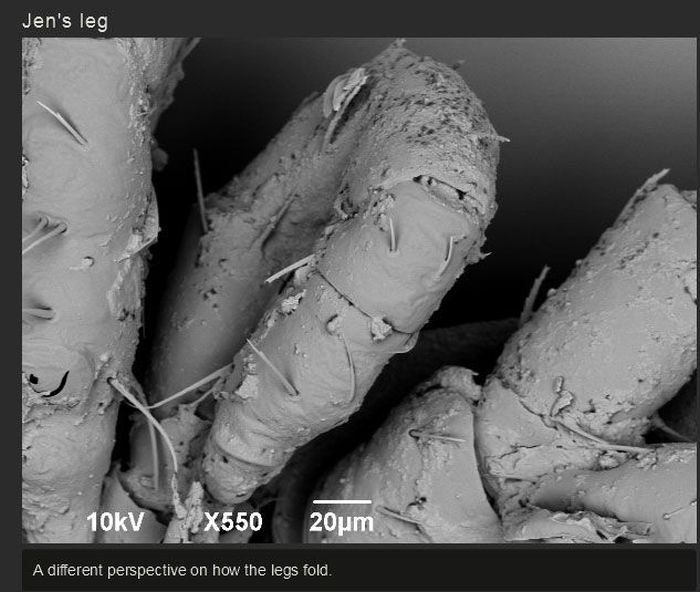 You Won't Believe What This Person Found On Their Foot (17 pics)