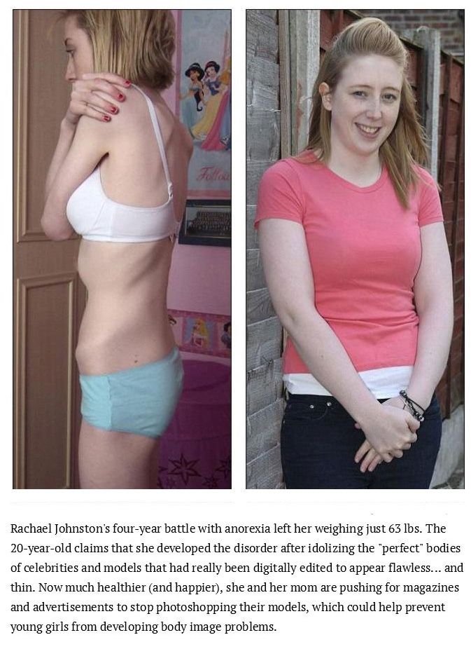 Inspiring Photos Of People Who Conquered Their Eating Disorders (15 pics)