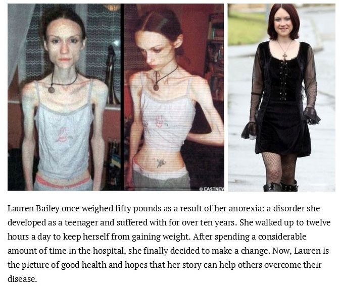Inspiring Photos Of People Who Conquered Their Eating Disorders (15 pics)
