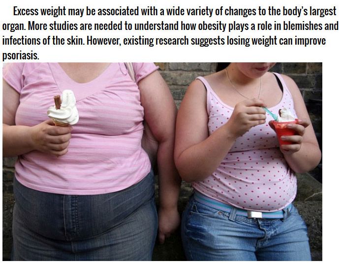 Great Reasons To Start Losing Weight Right Away (11 pics)