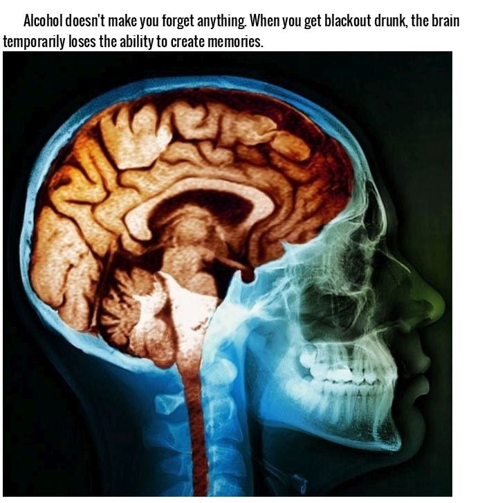 Things You Didn't Know Effect Your Brain In A Big Way (15 pics)