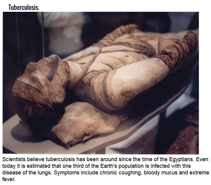 Deadly Diseases That Aren't Ebola (6 pics)