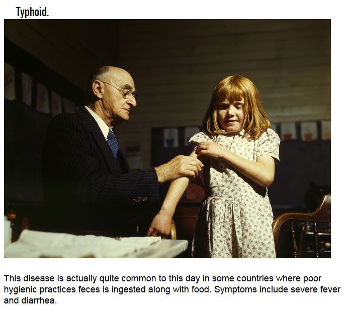 Deadly Diseases That Aren't Ebola (6 pics)