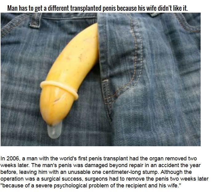 Strange Organ Transplant Stories From Around The World (10 pics)