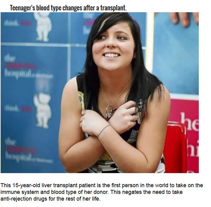 Strange Organ Transplant Stories From Around The World (10 pics)