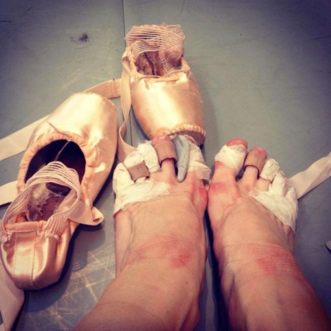 What The Danish Royal Ballet Does To Your Feet  (2 pics)