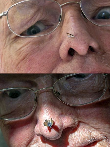 Acid Picdump (106 pics)