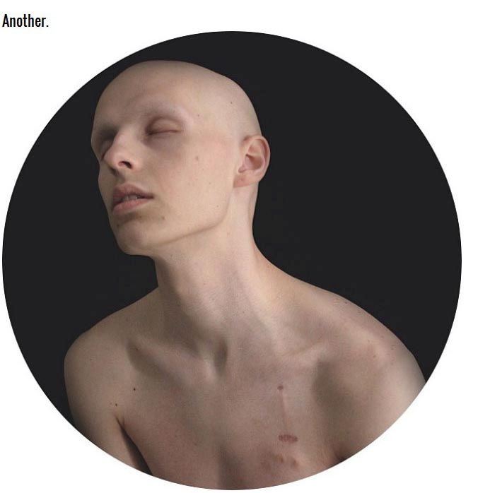 This Teen Documented His Battle With Cancer And It's Inspirational (15 pics)