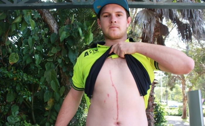 Man Gets Spider Pulled Out Of His Stomach (5 pics)