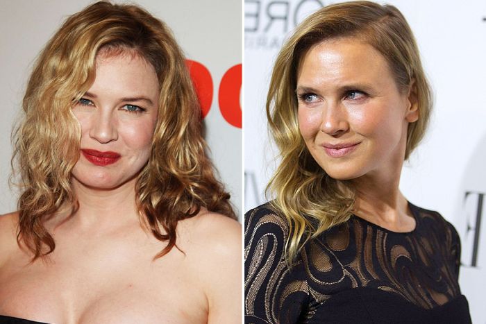 Everyone Is Talking About How Renee Zellweger Looks Now (10 pics)