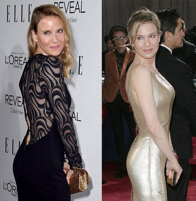 Everyone Is Talking About How Renee Zellweger Looks Now (10 pics)