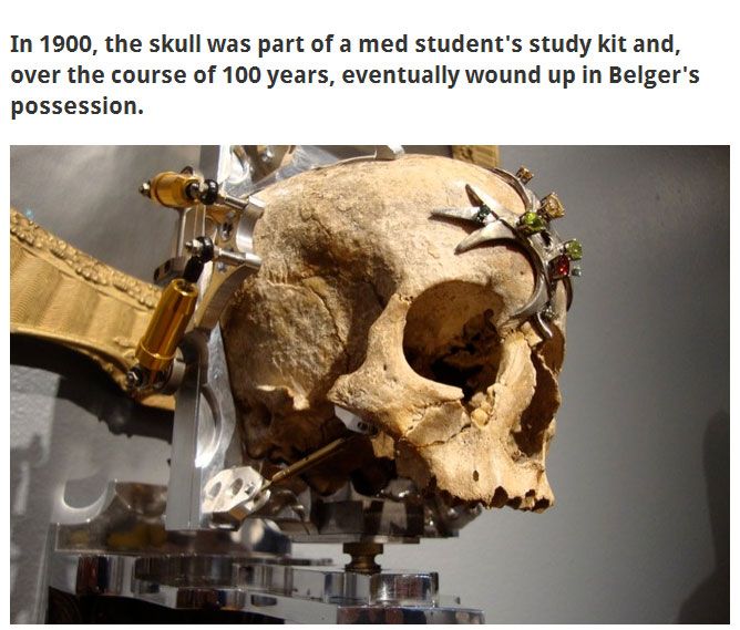 This Human Skull Is Now A Camera (12 pics)