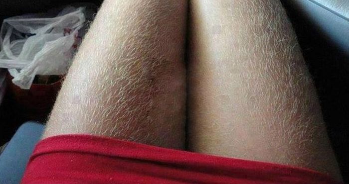 Acid Picdump (115 pics)