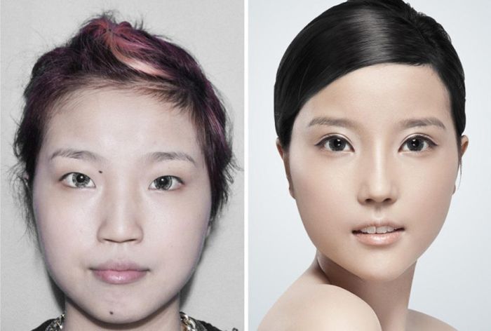 Plastic Surgery Is Popular In Asia (19 pics)