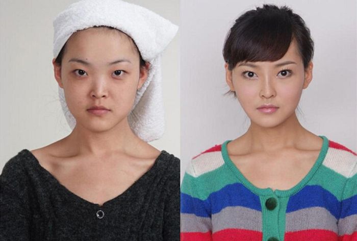 Plastic Surgery Is Popular In Asia (19 pics)