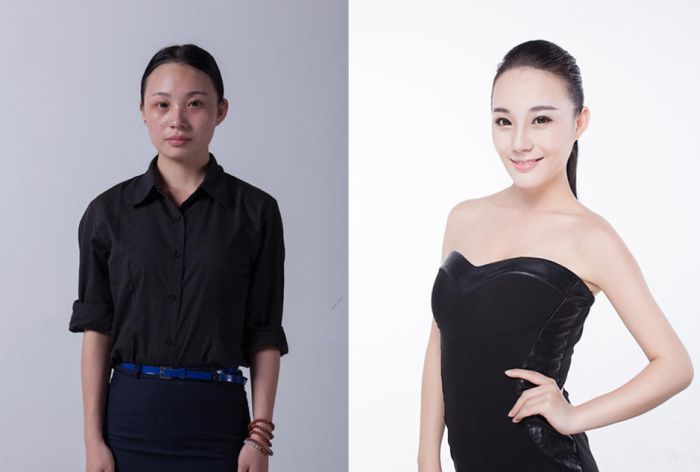 Plastic Surgery Is Popular In Asia (19 pics)