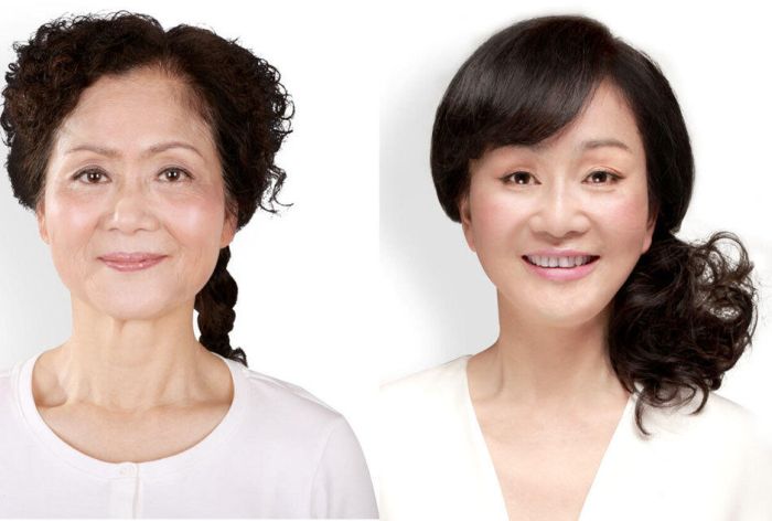 Plastic Surgery Is Popular In Asia (19 pics)