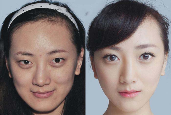 Plastic Surgery Is Popular In Asia (19 pics)