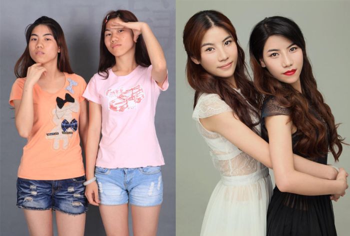 Plastic Surgery Is Popular In Asia (19 pics)