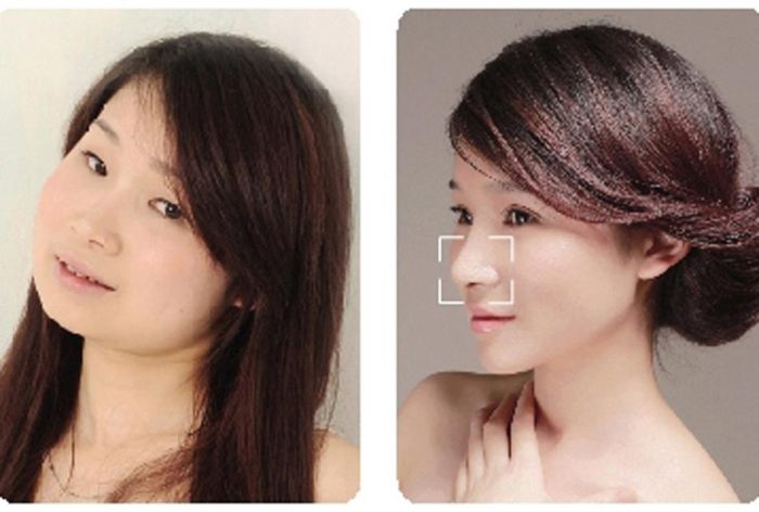 Plastic Surgery Is Popular In Asia (19 pics)