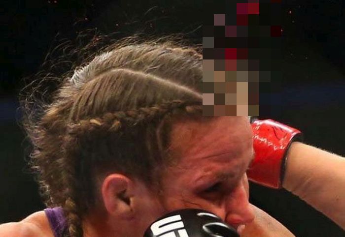 Leslie Smiths Ear Explodes At Ufc 180 5 Pics 