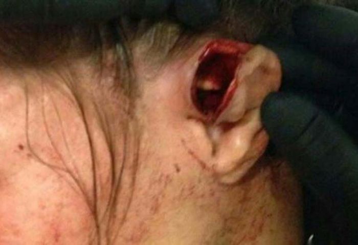 Leslie Smith's Ear Explodes At UFC 180 (5 pics)
