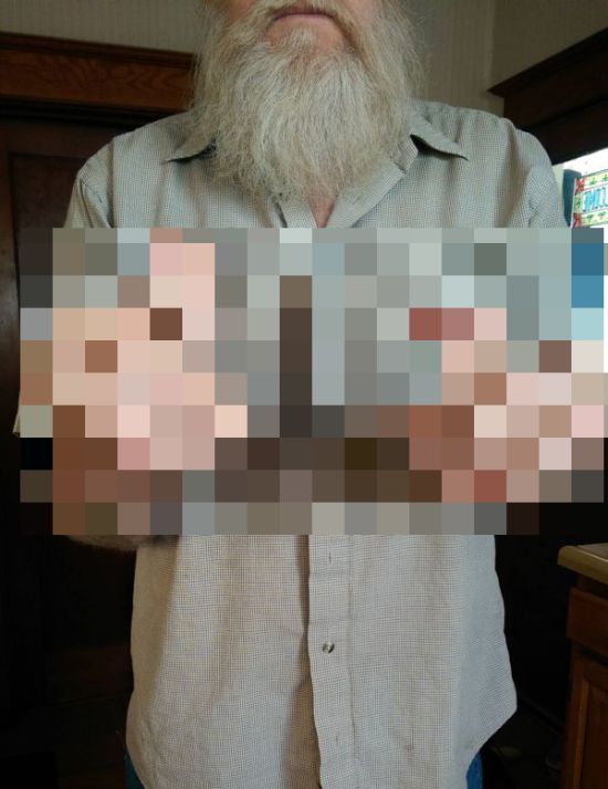 Six Fingers (3 pics)