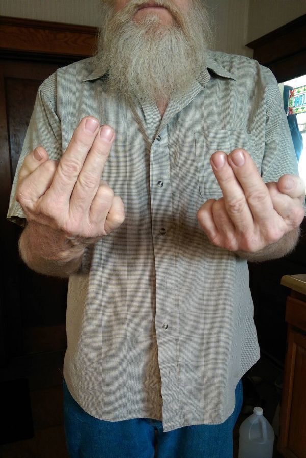 Six Fingers (3 pics)